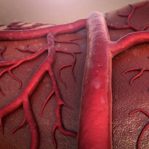 New drug Actemra approved for giant cell arteritis